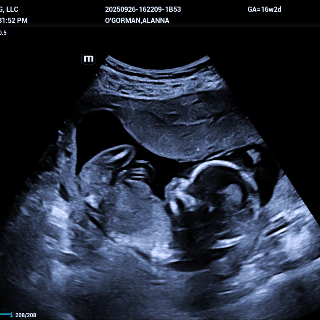 Photo shared by Alanna for their Babylist baby registry.