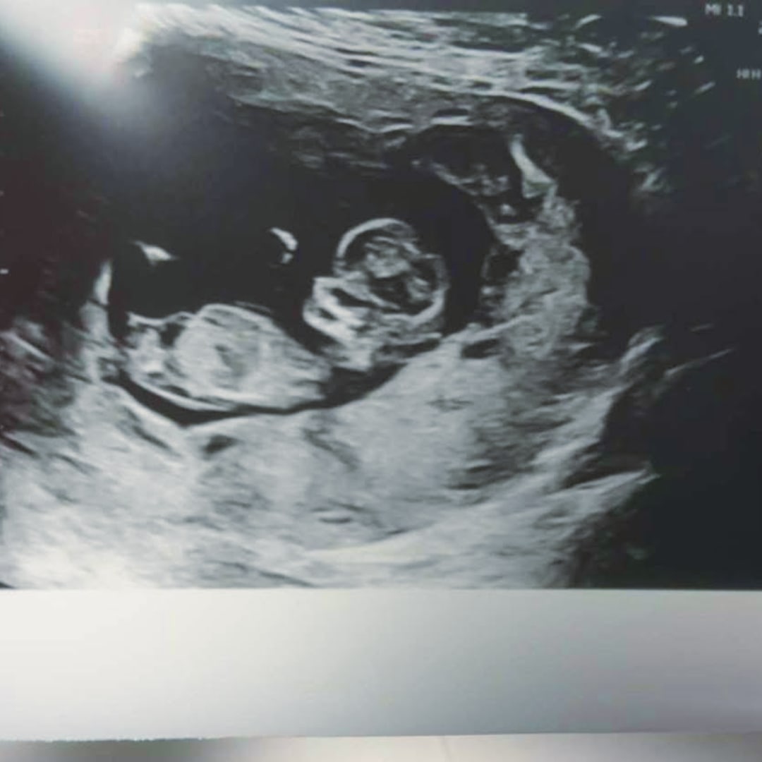 Photo shared by RayeAnne for their Babylist baby registry.