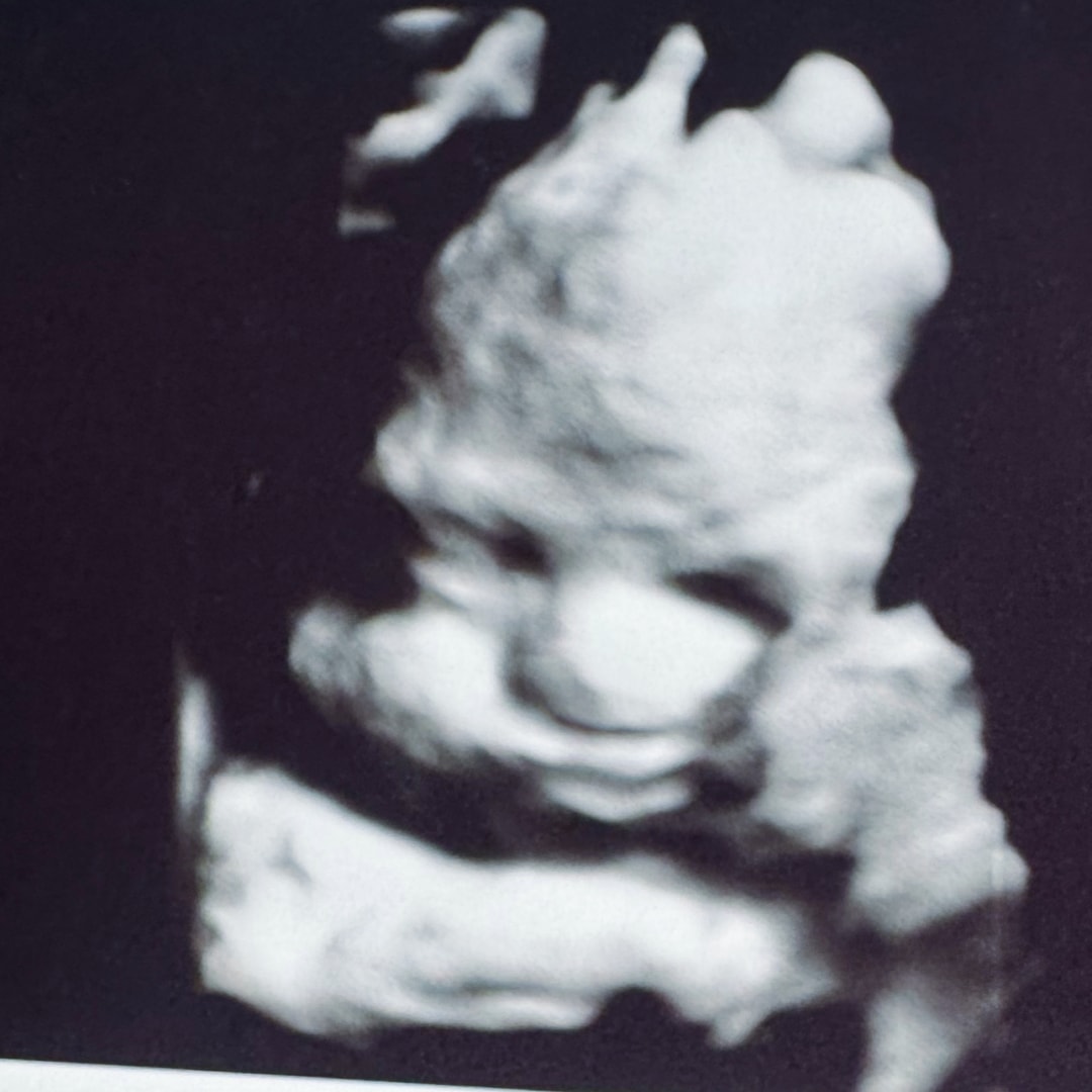Photo shared by Caitlin for their Babylist baby registry.