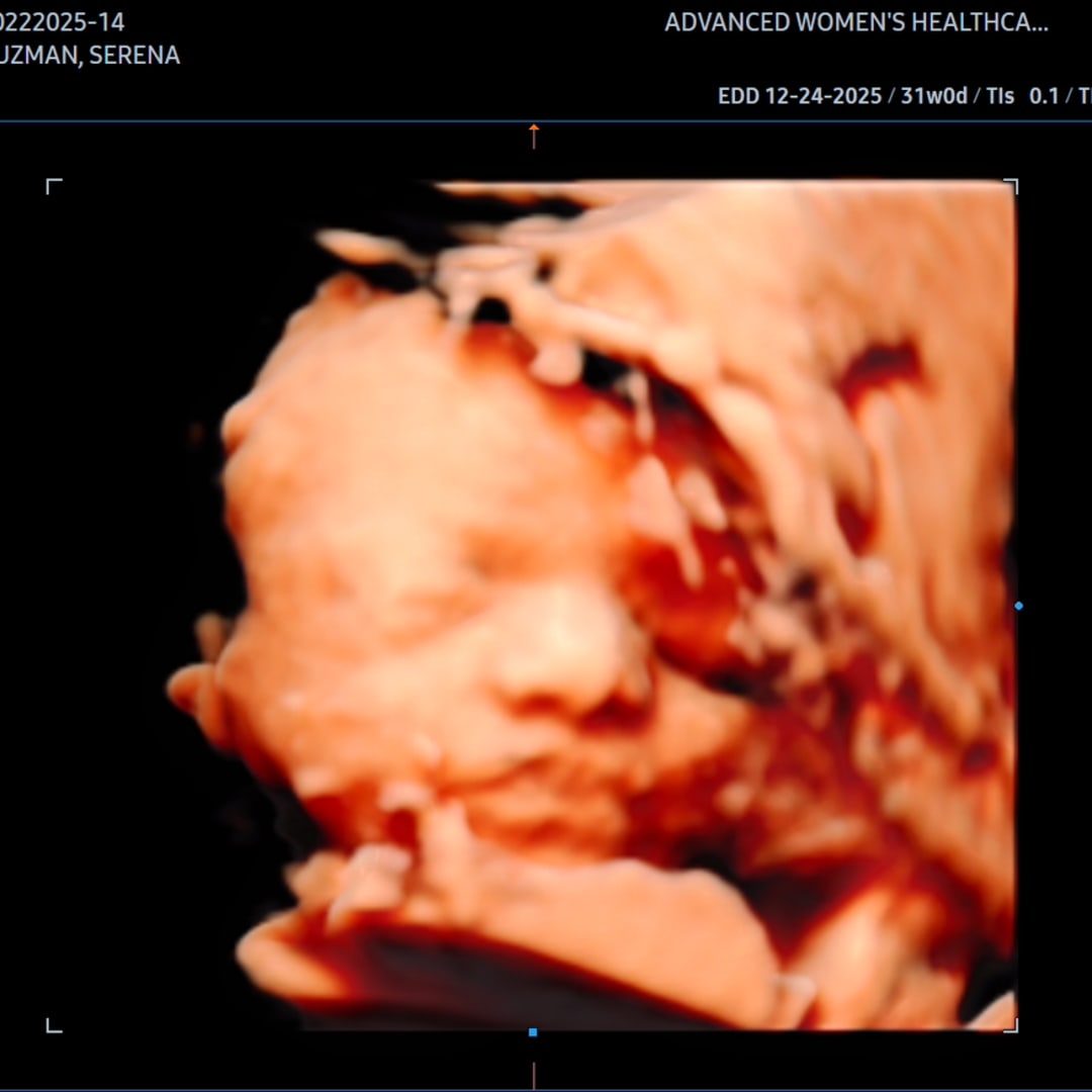 Photo shared by Serena for their Babylist baby registry.