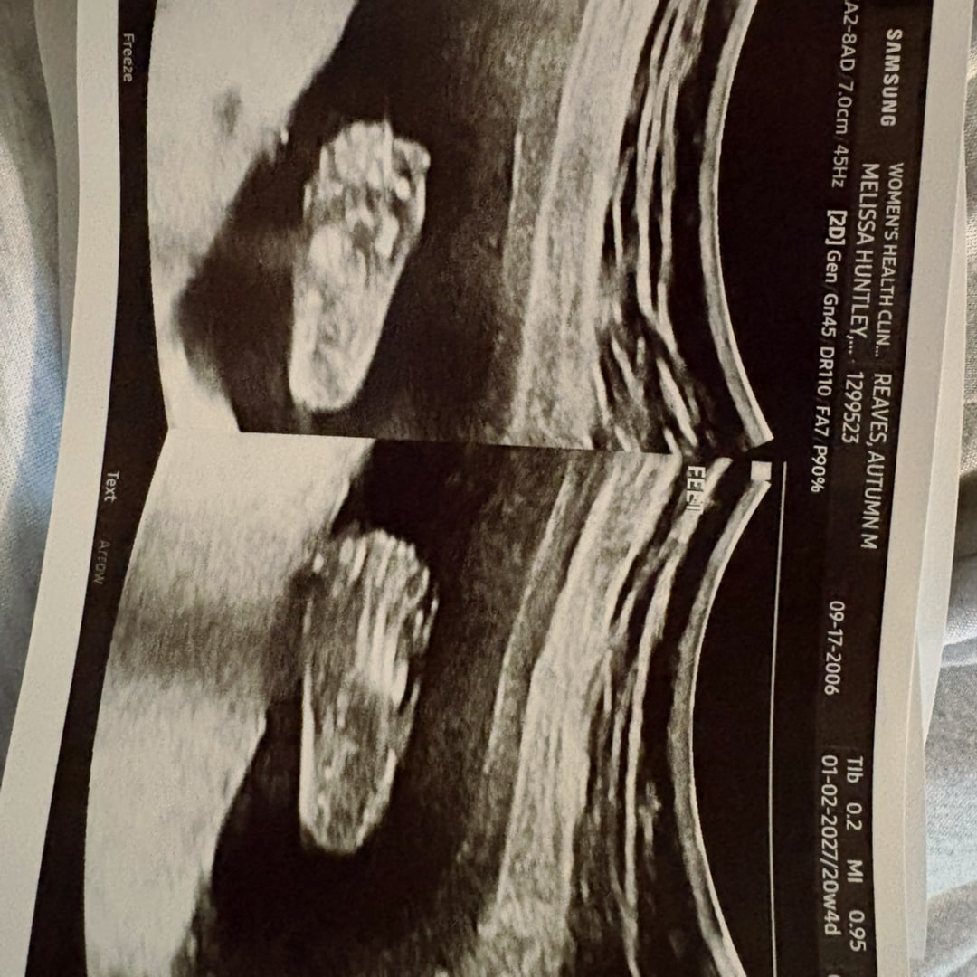 Photo shared by Autumn for their Babylist baby registry.