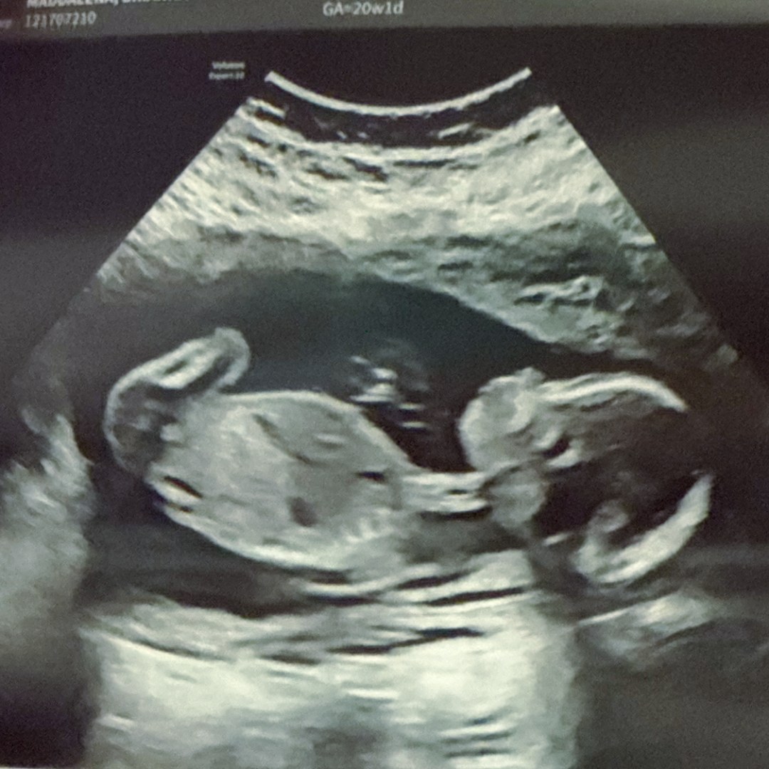 Photo shared by Brianna for their Babylist baby registry.