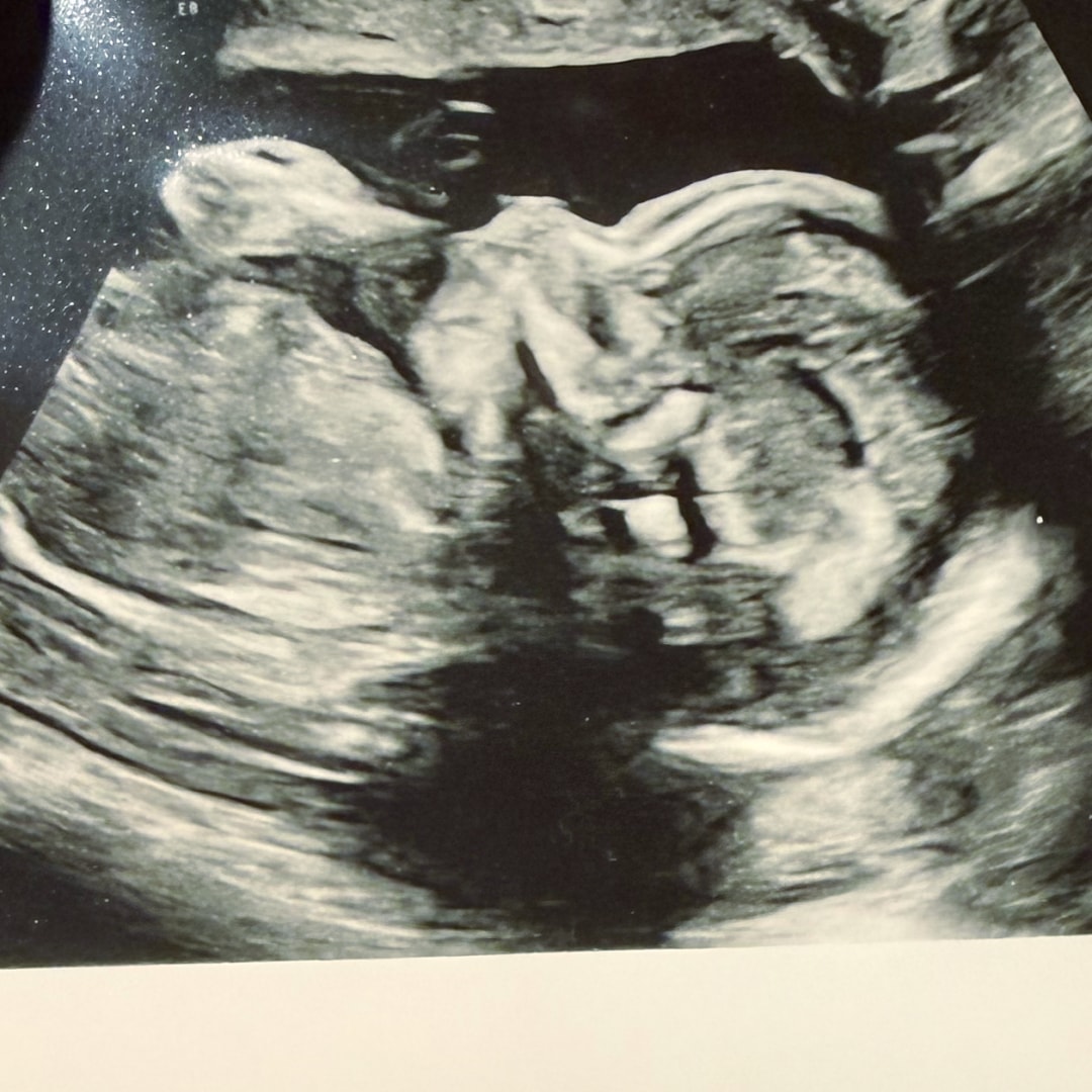 Photo shared by Kaitlin for their Babylist baby registry.