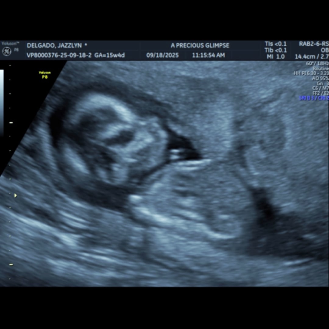 Photo shared by Jazzlynn for their Babylist baby registry.