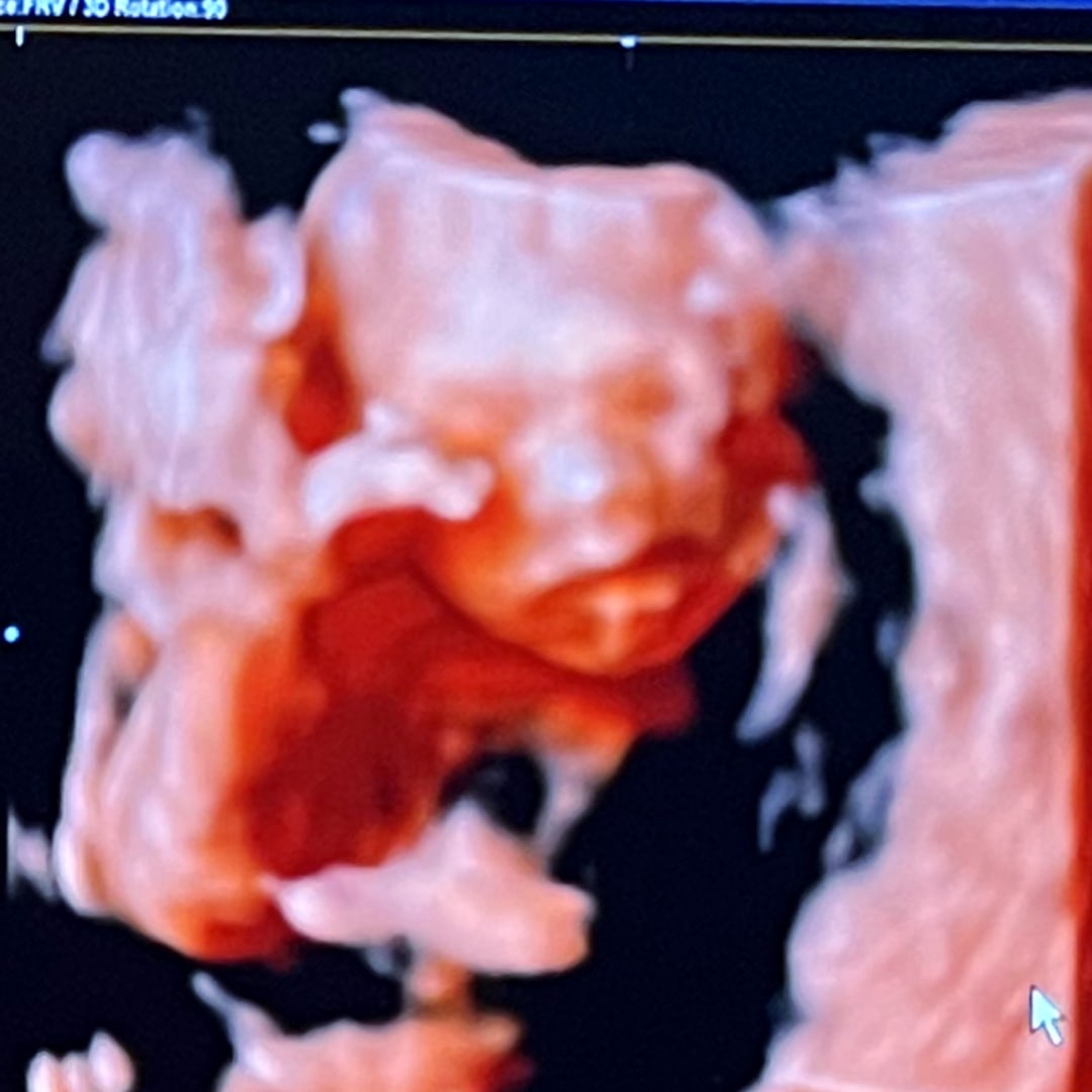 Photo shared by Siana for their Babylist baby registry.