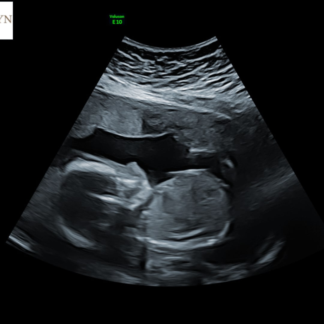 Photo shared by Kaycee for their Babylist baby registry.