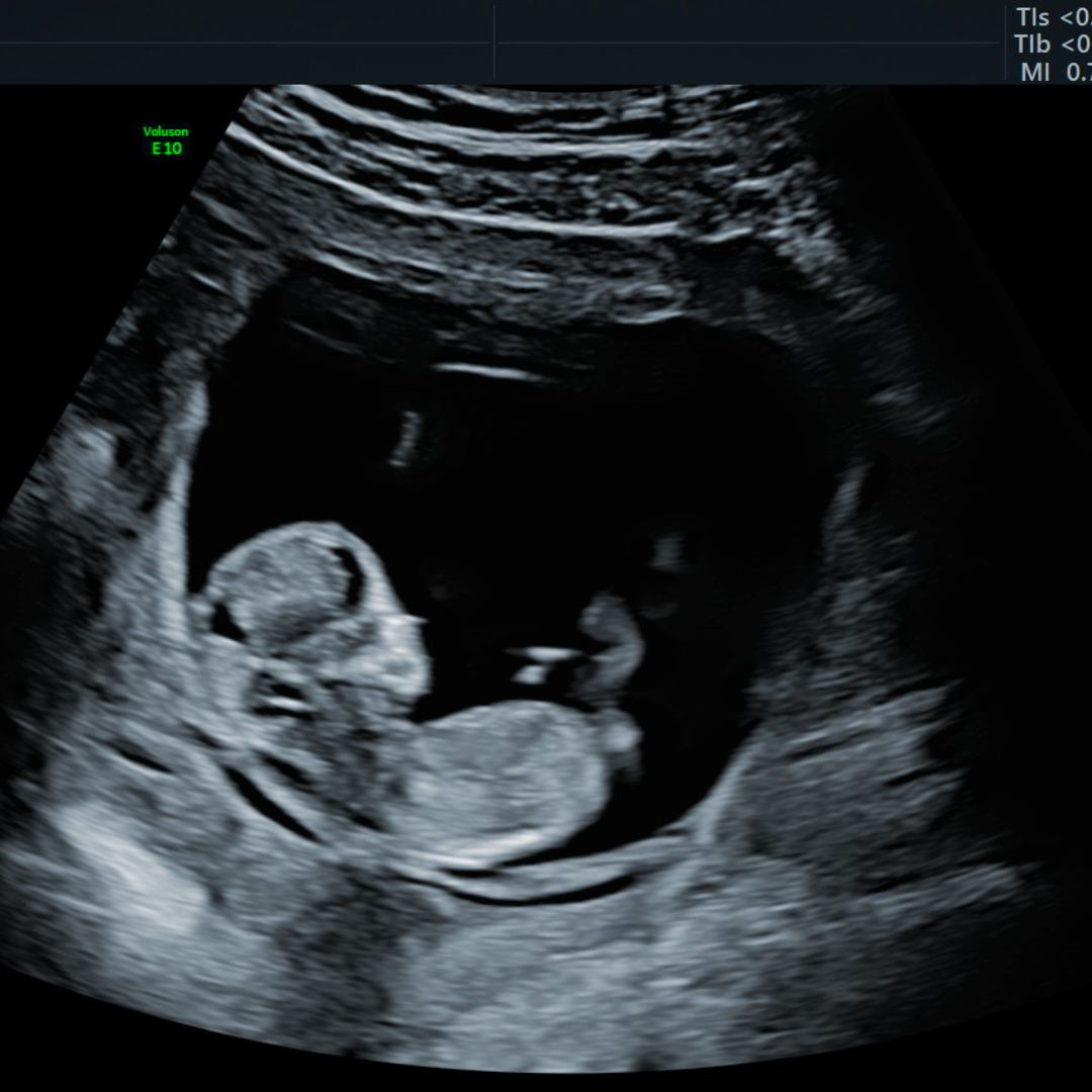 Photo shared by Kirsten for their Babylist baby registry.