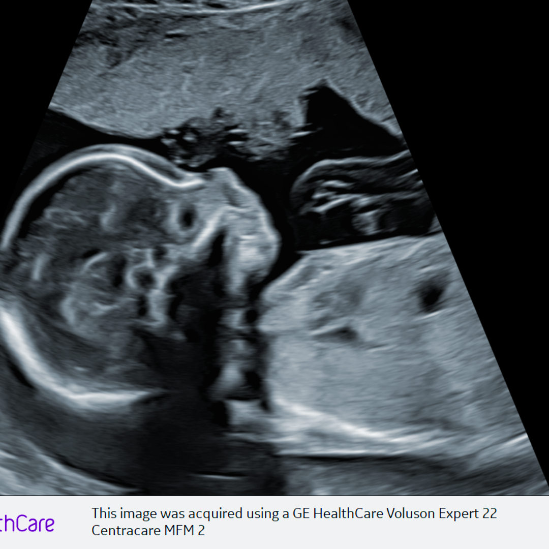 Photo shared by Brianna for their Babylist baby registry.