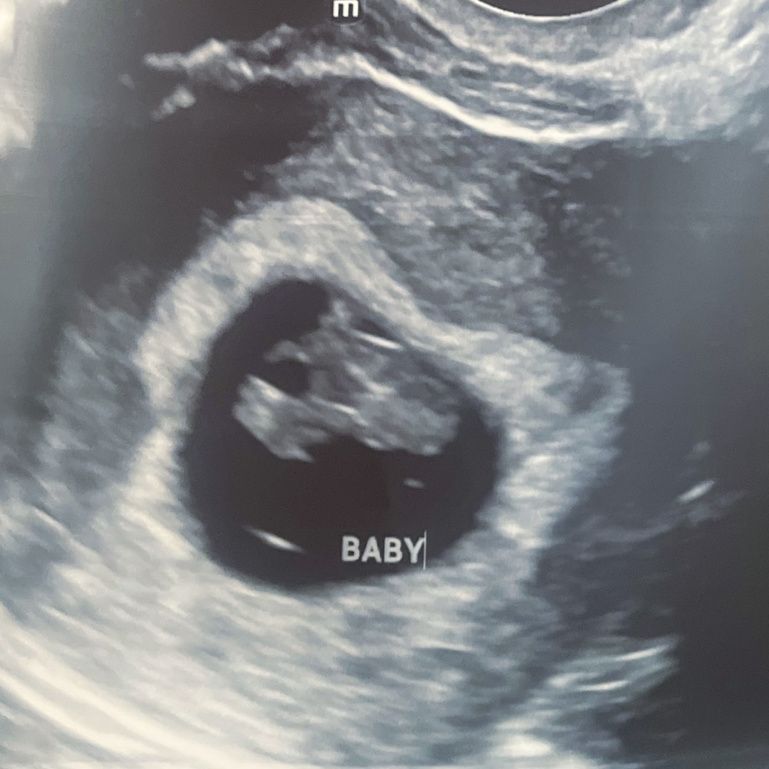 Photo shared by Stephanie for their Babylist baby registry.