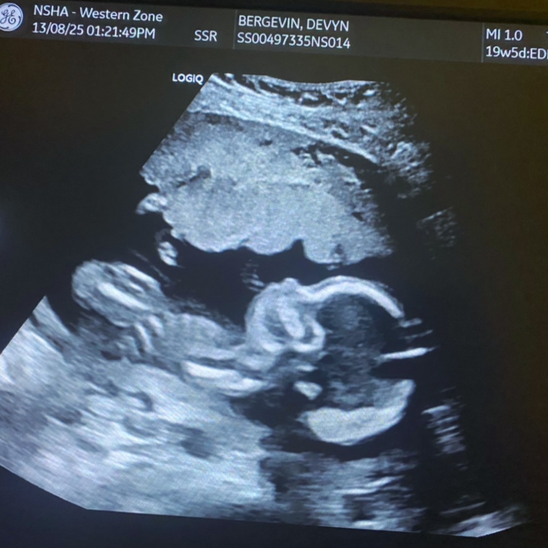 Photo shared by Devyn for their Babylist baby registry.