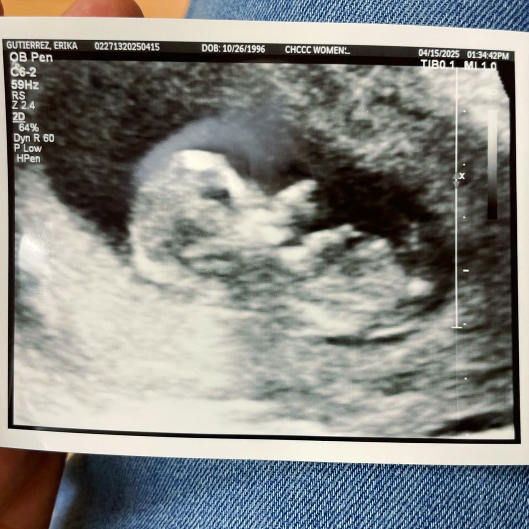 Photo shared by Erika for their Babylist baby registry.