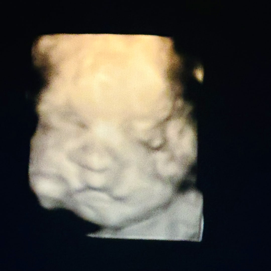 Photo shared by Estrella for their Babylist baby registry.