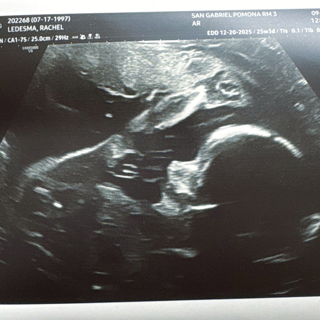Photo shared by Rachel for their Babylist baby registry.