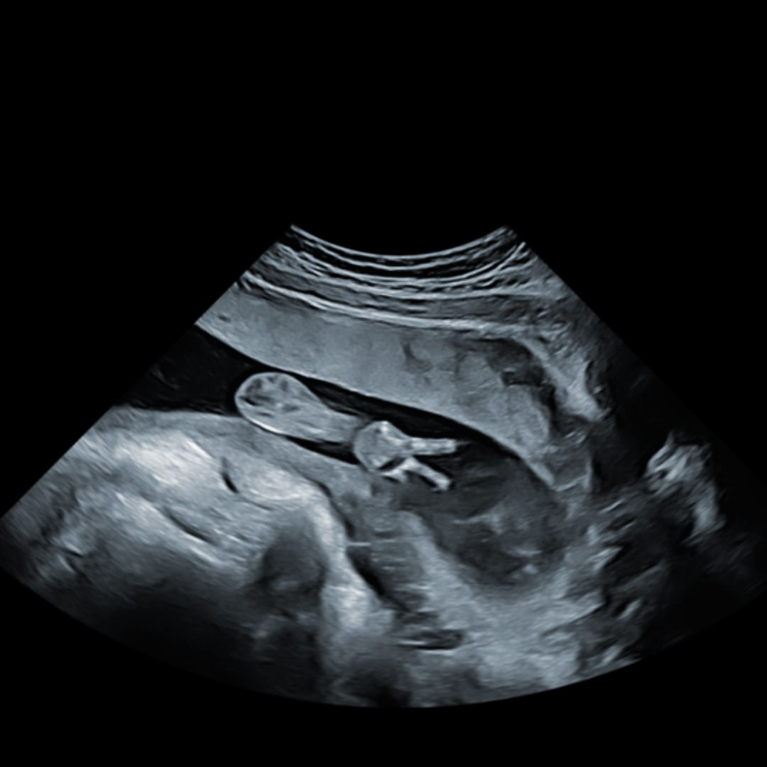 Photo shared by Allie for their Babylist baby registry.
