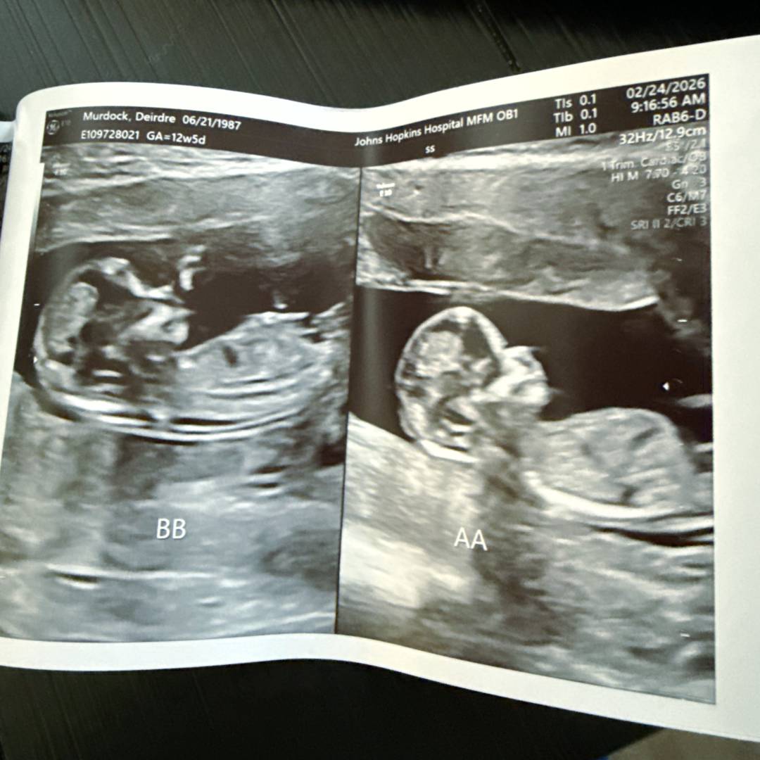 Photo shared by Deirdre for their Babylist baby registry.