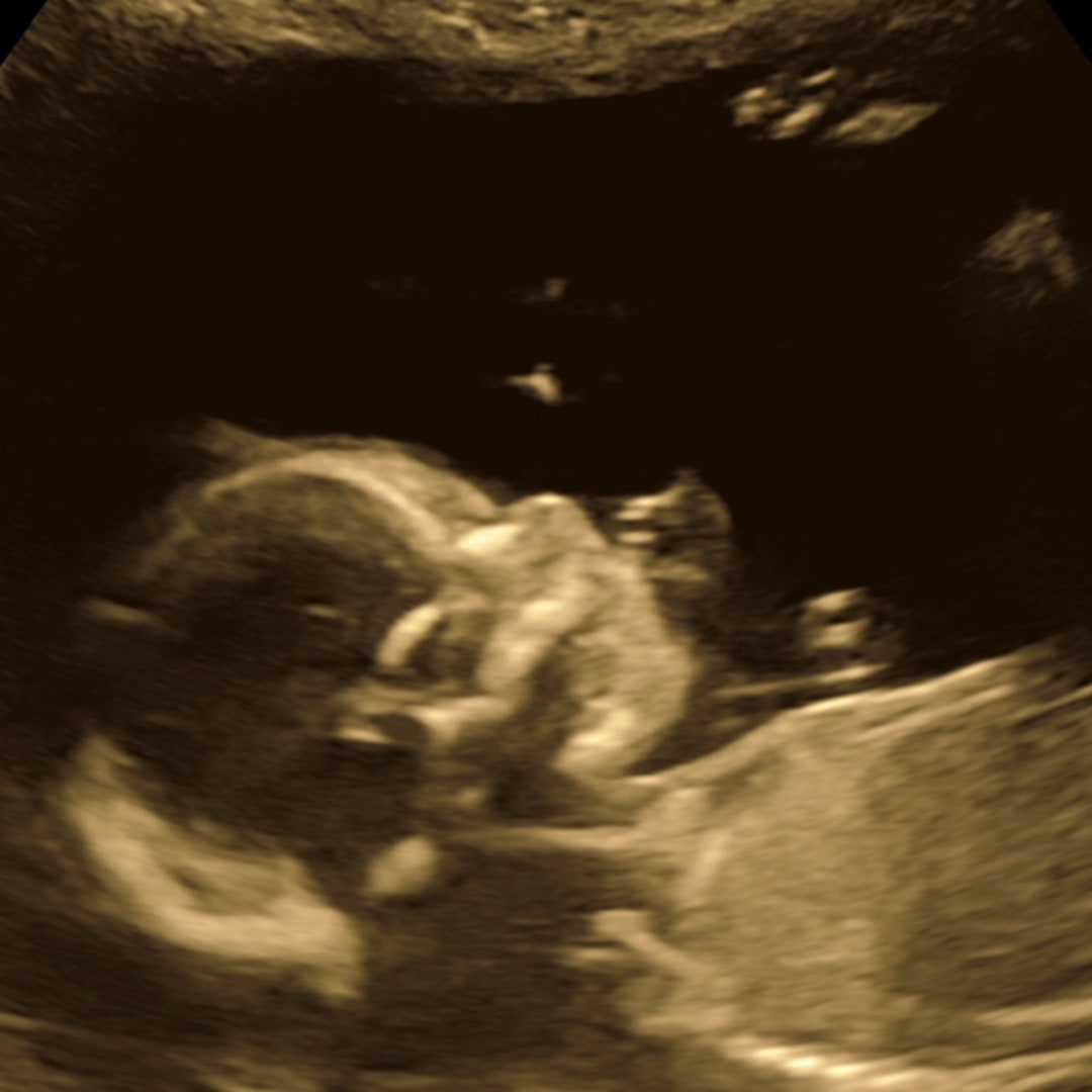 Photo shared by Lizzy for their Babylist baby registry.