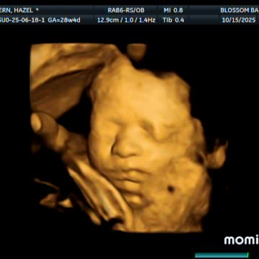 Photo shared by Hazel for their Babylist baby registry.