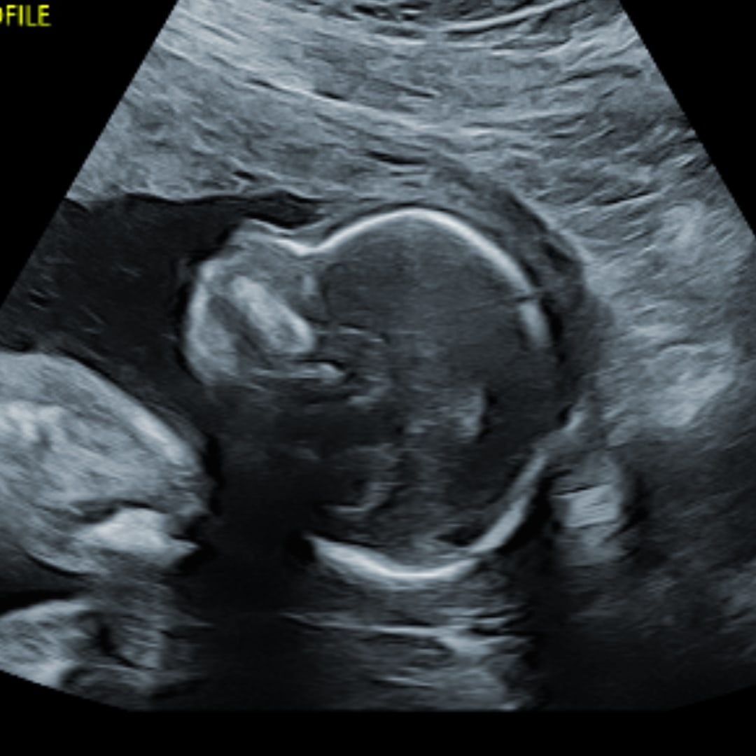 Photo shared by Grace for their Babylist baby registry.