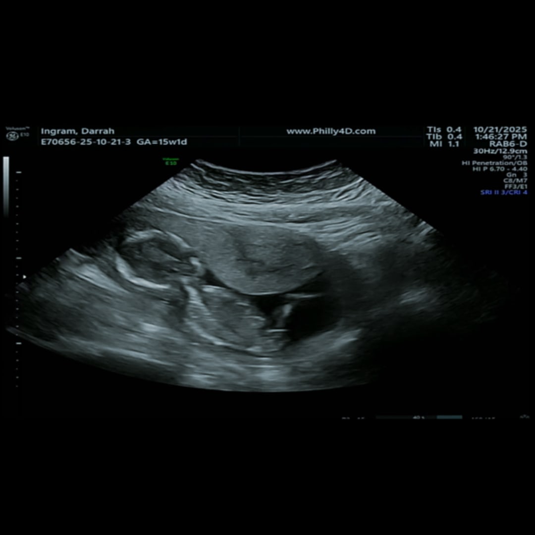 Photo shared by Darrah for their Babylist baby registry.