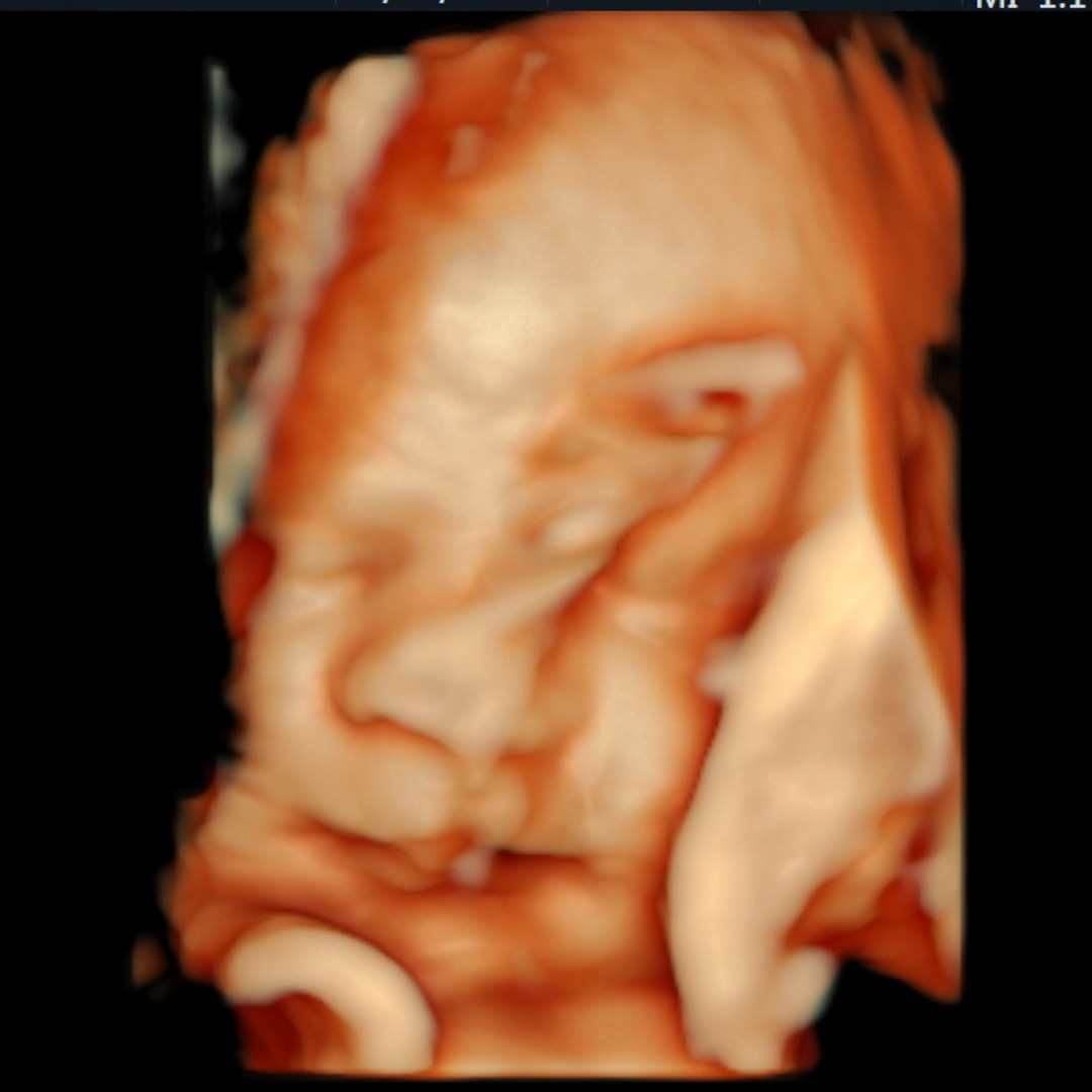 Photo shared by Ashley for their Babylist baby registry.