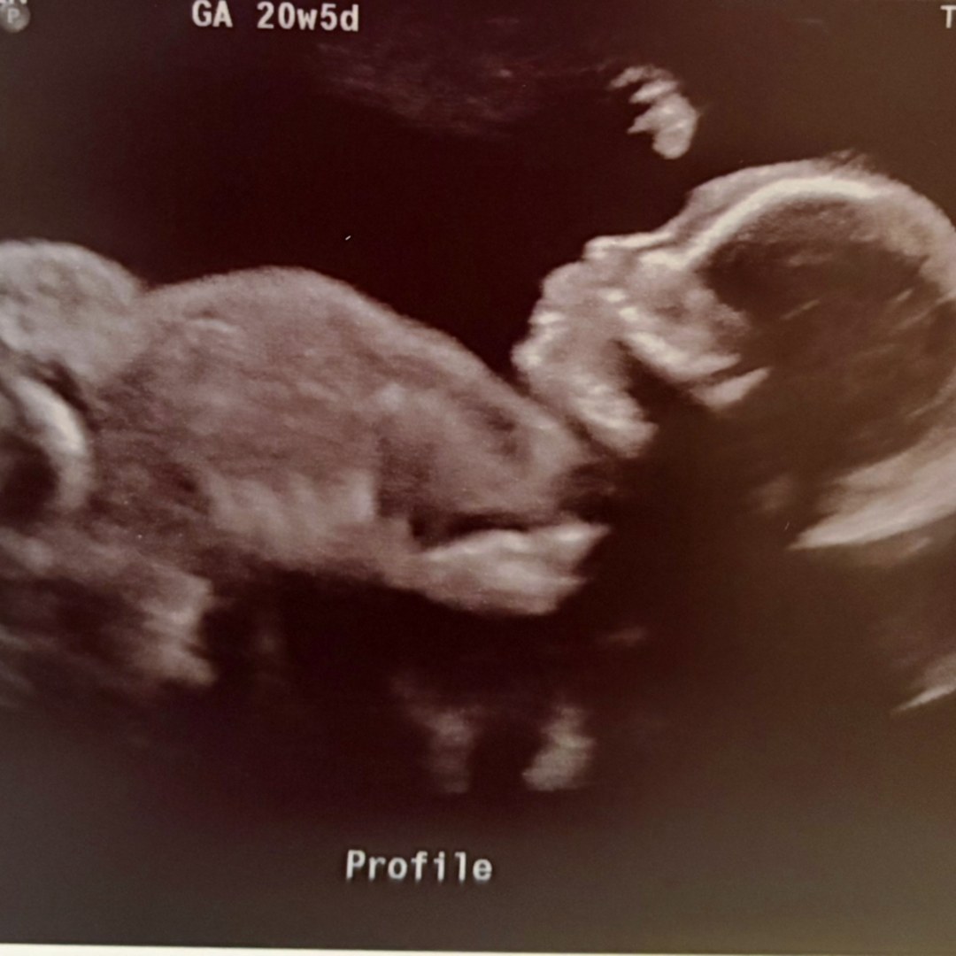 Photo shared by Lani for their Babylist baby registry.