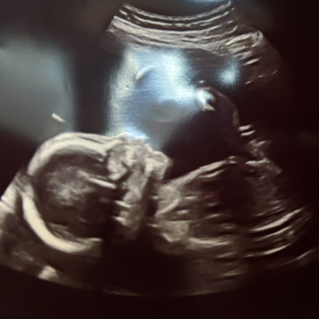 Photo shared by Adelia for their Babylist baby registry.