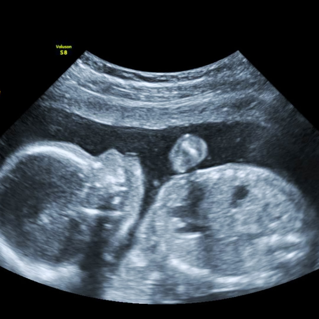 Photo shared by Victoria for their Babylist baby registry.