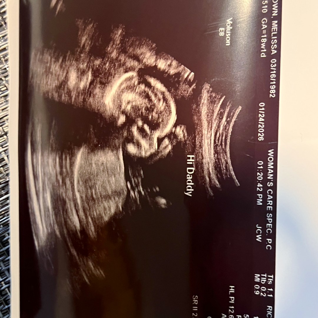 Photo shared by Melissa for their Babylist baby registry.