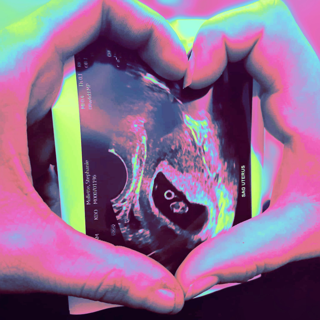 Photo shared by Frankie for their Babylist baby registry.