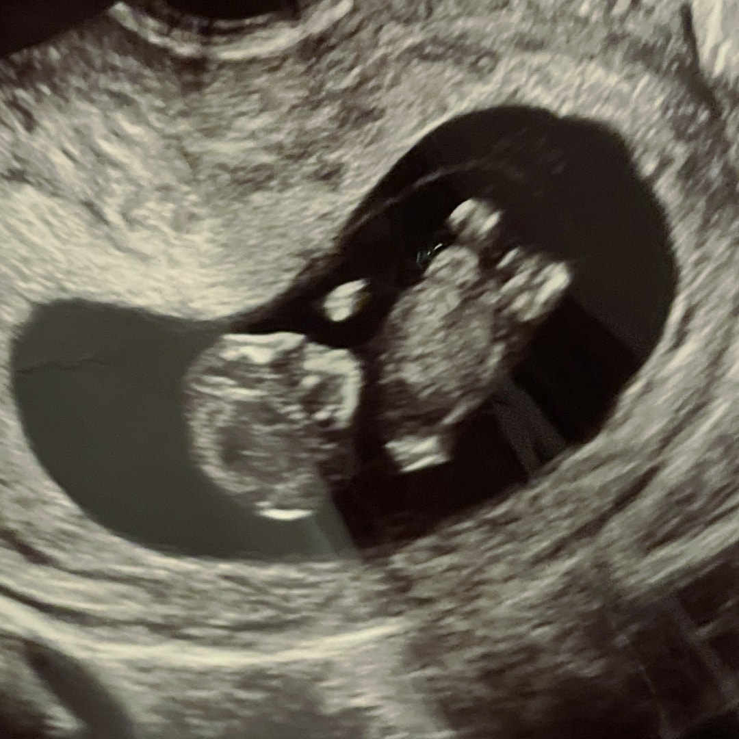 Photo shared by Hailey for their Babylist baby registry.