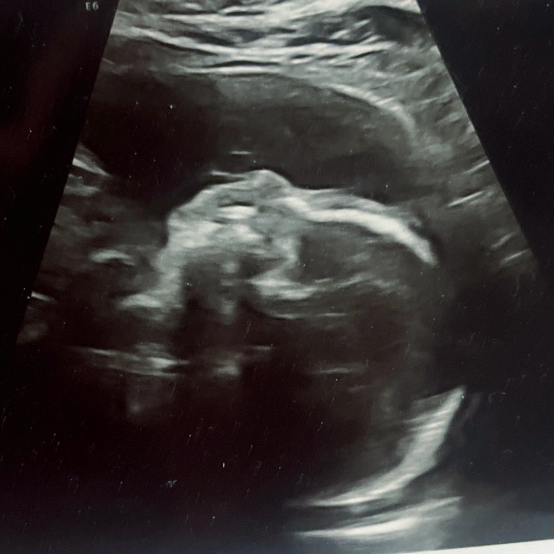 Photo shared by Stephanie for their Babylist baby registry.