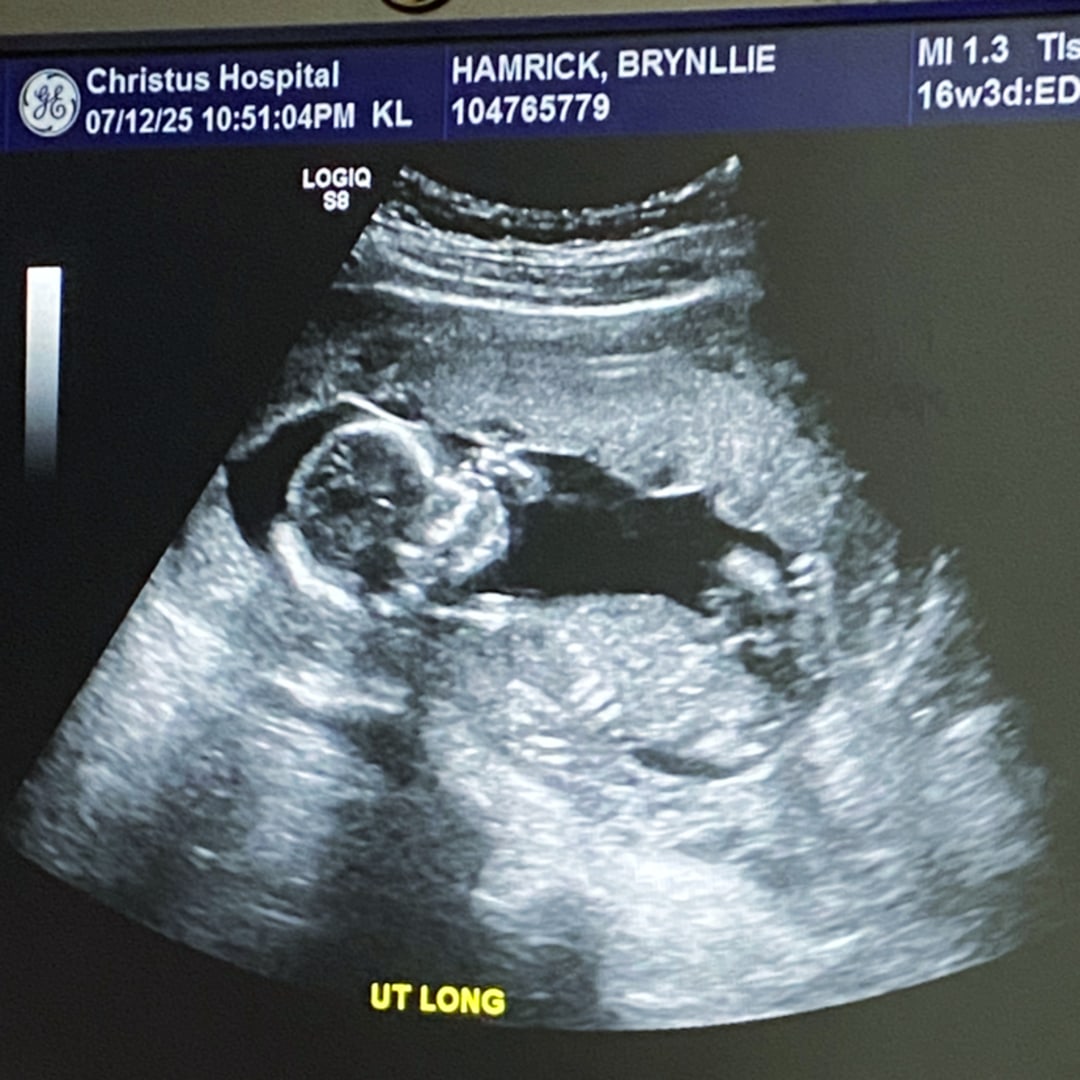 Photo shared by Brynllie for their Babylist baby registry.