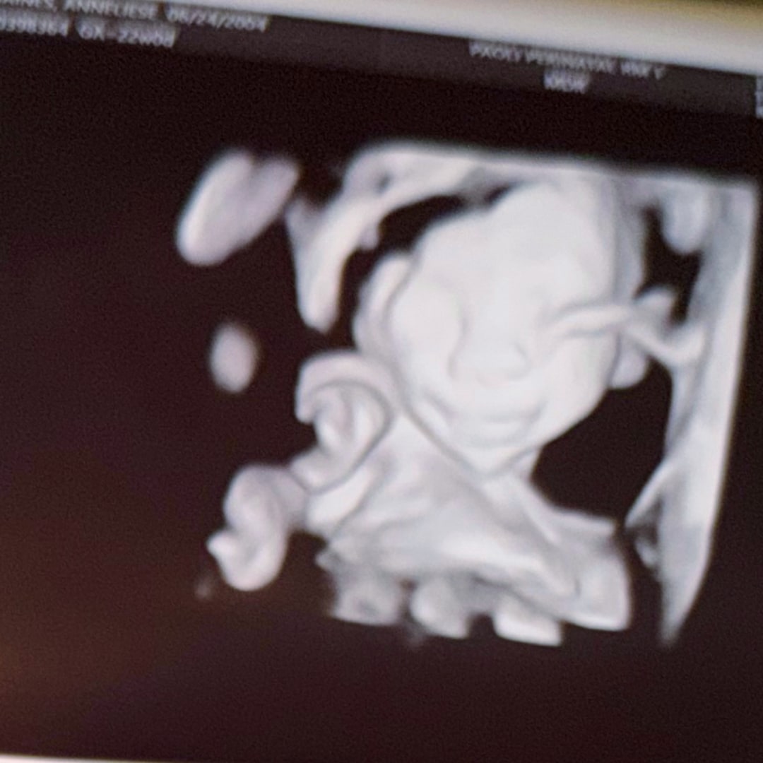 Photo shared by Anneliese for their Babylist baby registry.