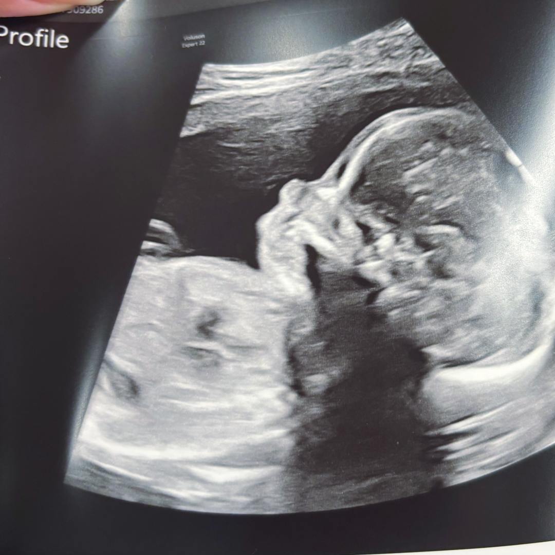 Photo shared by Cassandra for their Babylist baby registry.