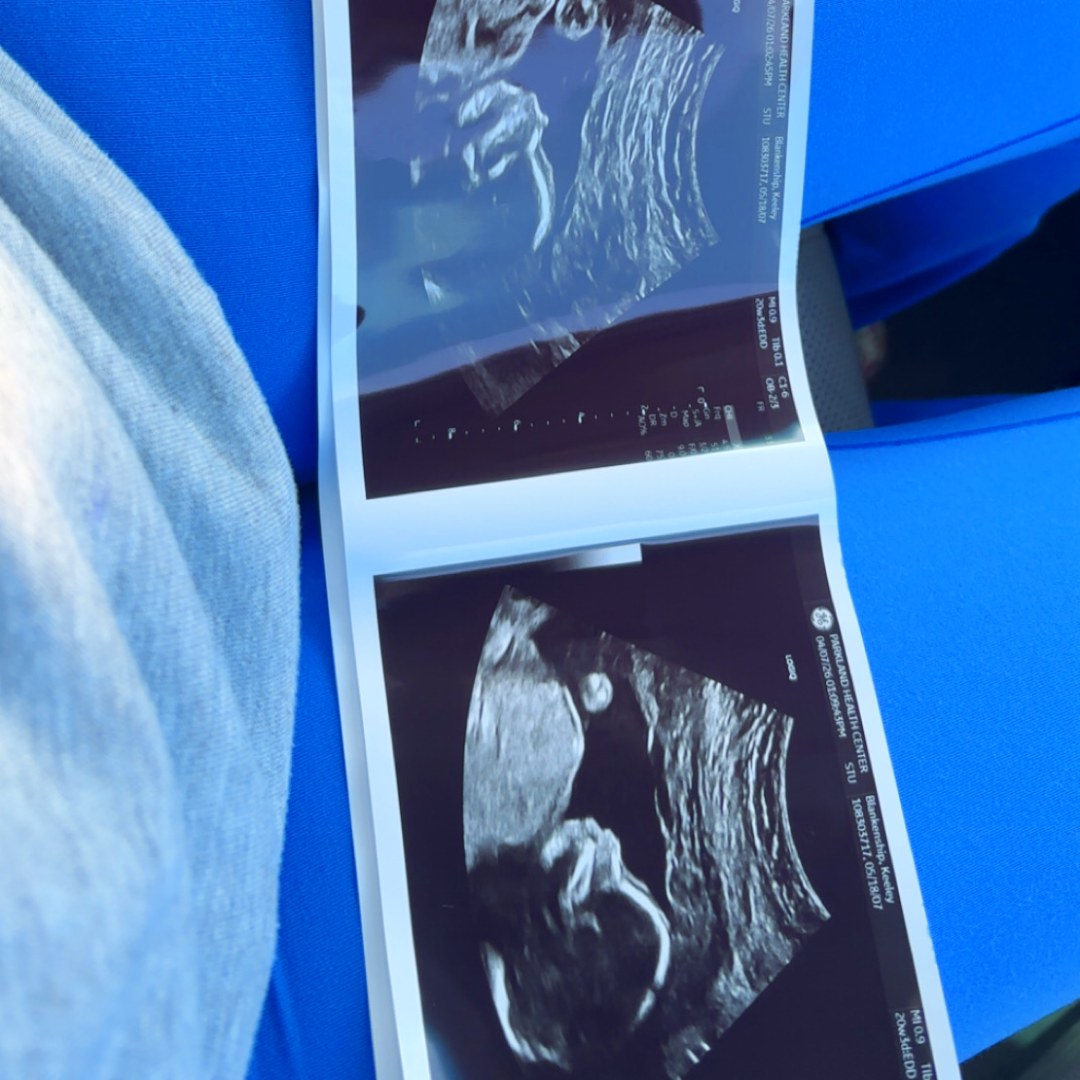 Photo shared by Keeley for their Babylist baby registry.