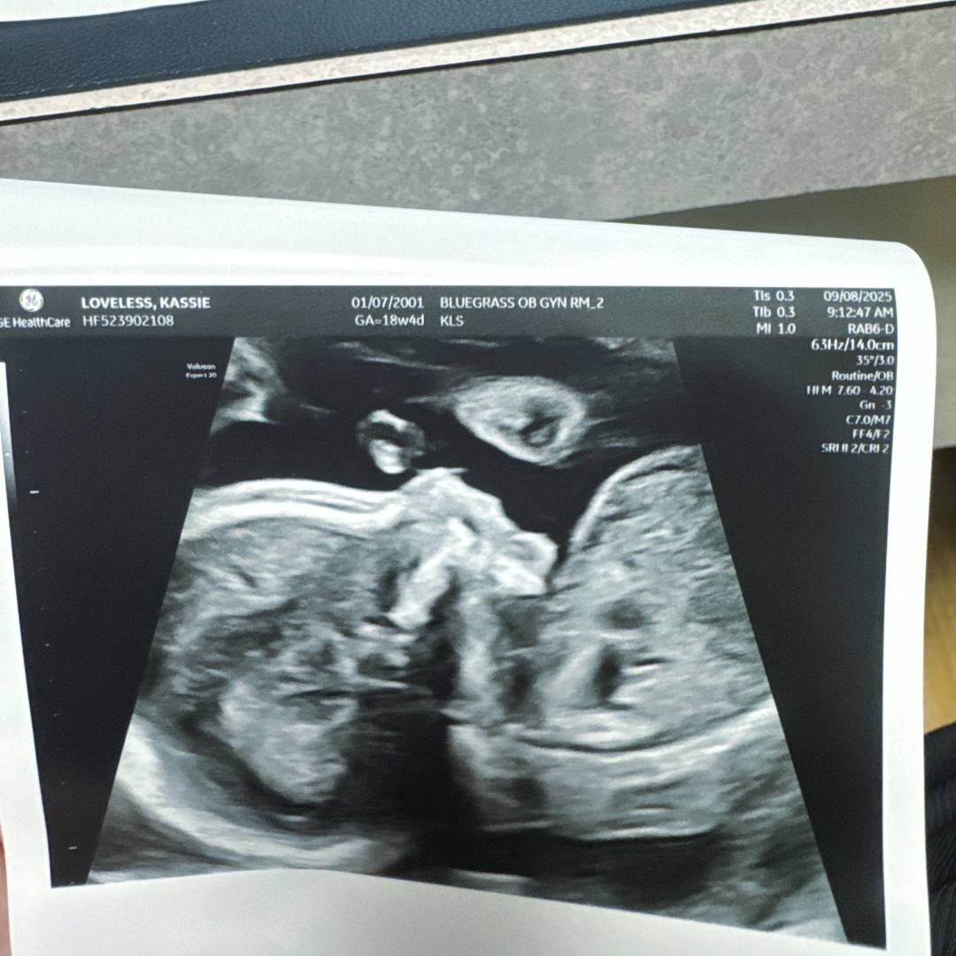 Photo shared by Kassie for their Babylist baby registry.
