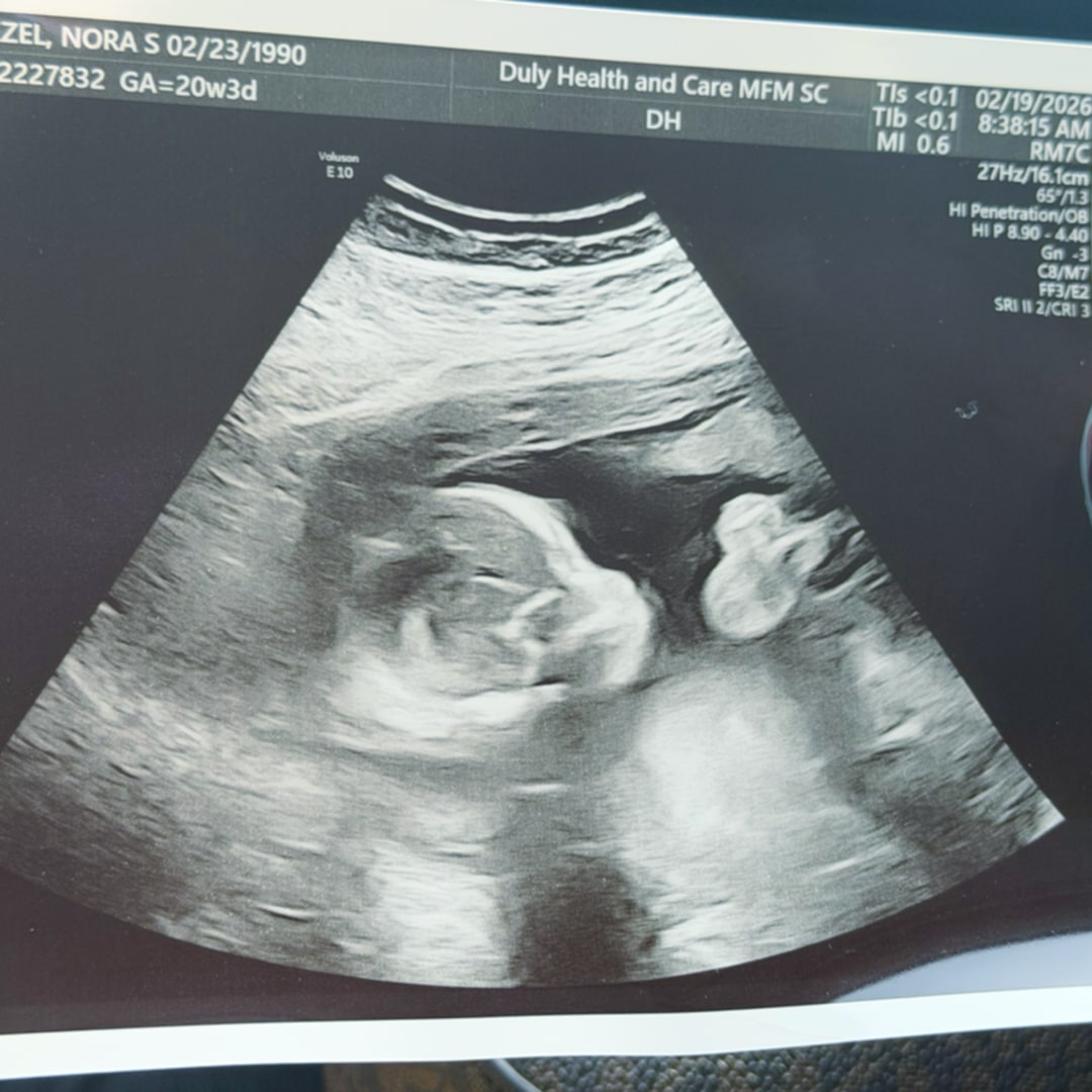 Photo shared by Stephanie for their Babylist baby registry.