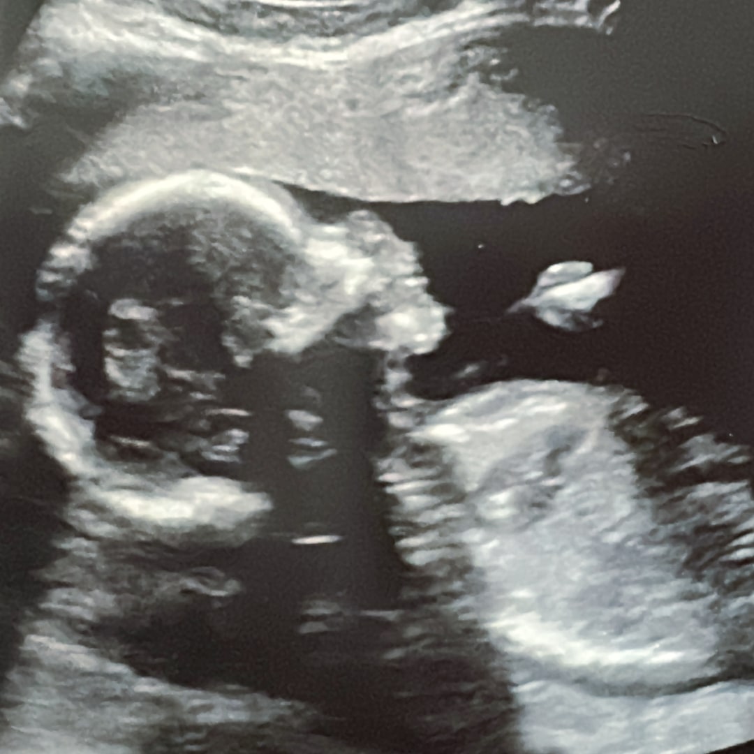 Photo shared by Mayelin for their Babylist baby registry.
