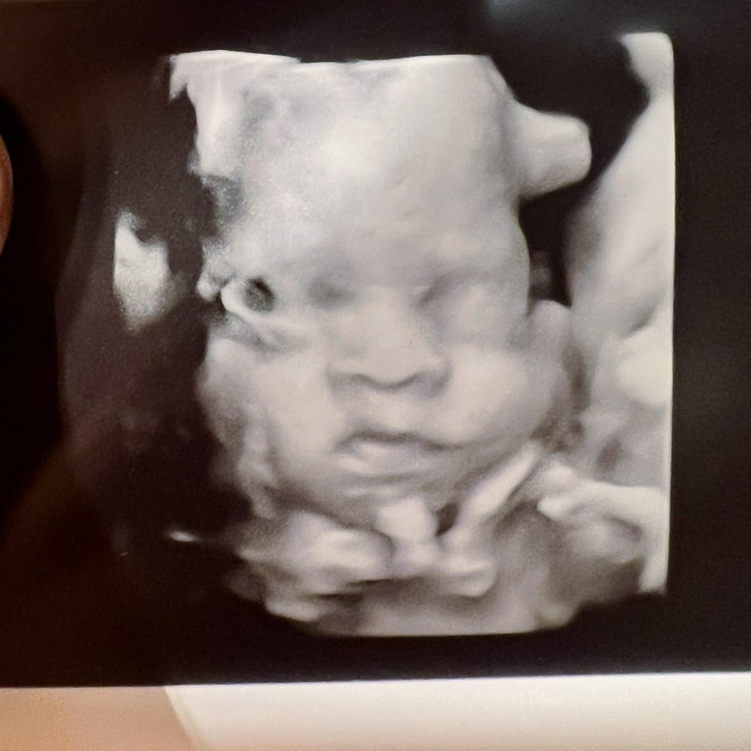 Photo shared by Samantha for their Babylist baby registry.