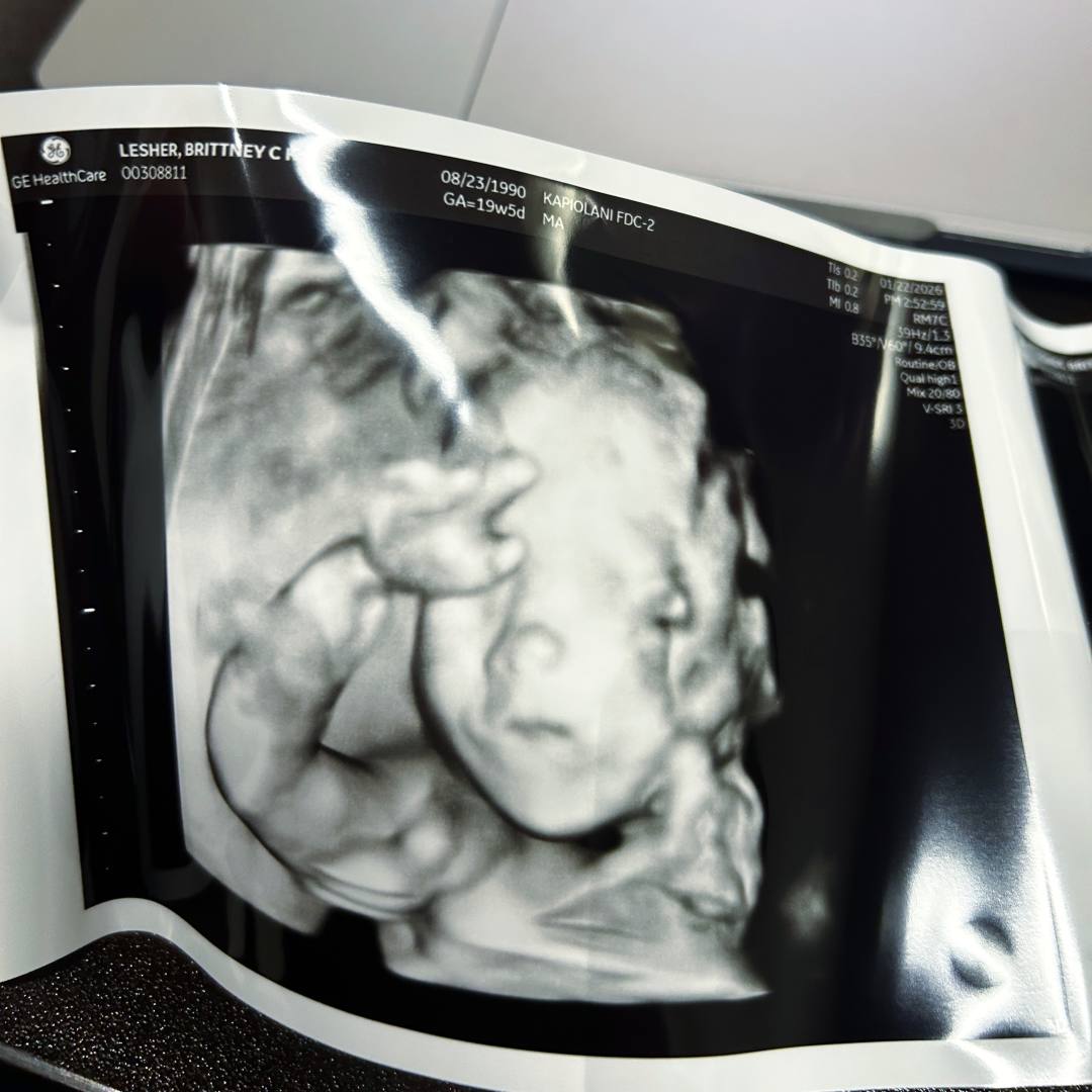 Photo shared by Brittney for their Babylist baby registry.