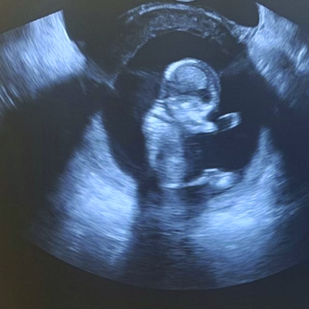 Photo shared by Yenifer for their Babylist baby registry.