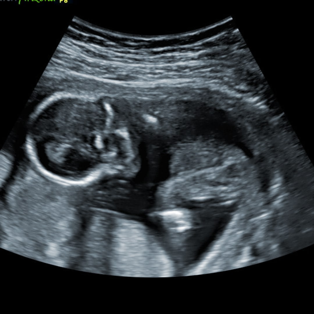 Photo shared by Delilah for their Babylist baby registry.