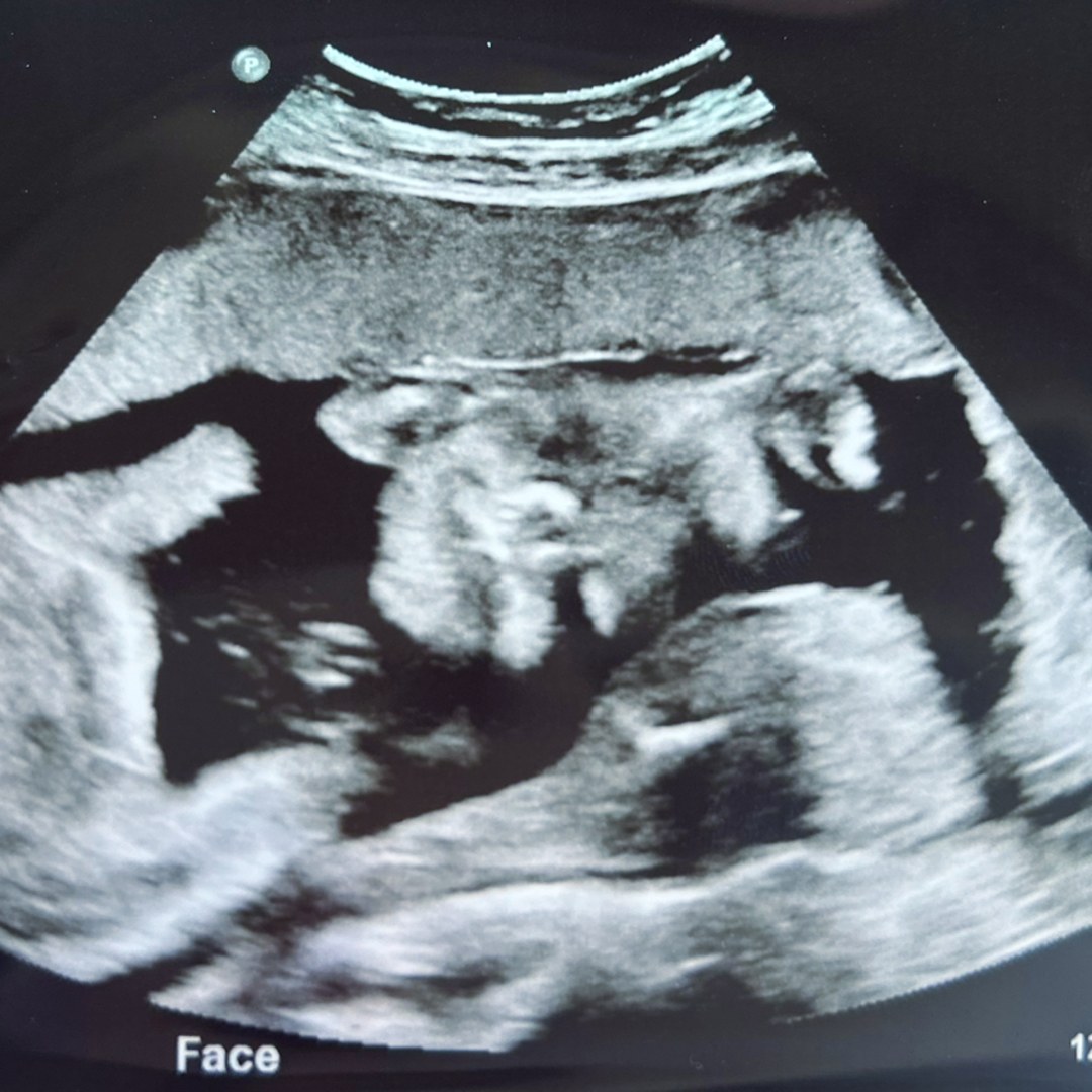 Photo shared by Gracie for their Babylist baby registry.