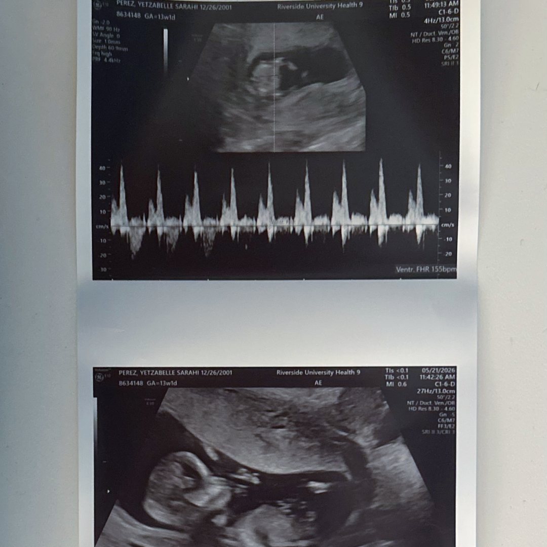 Photo shared by Yetzabelle S for their Babylist baby registry.