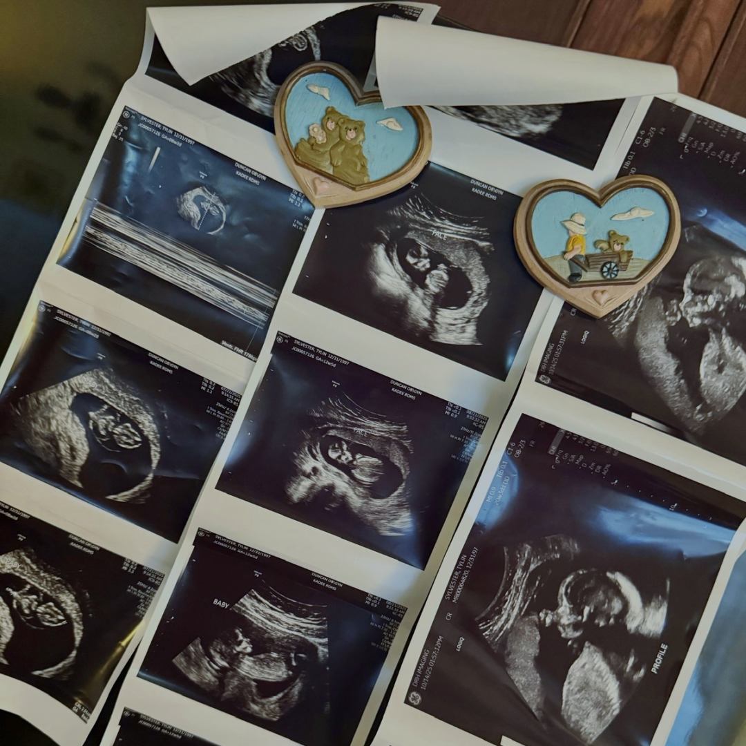 Photo shared by Tylin for their Babylist baby registry.