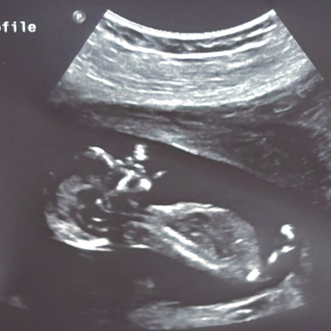 Photo shared by Alexis for their Babylist baby registry.