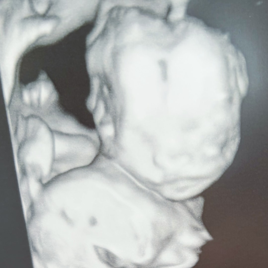 Photo shared by Diana for their Babylist baby registry.