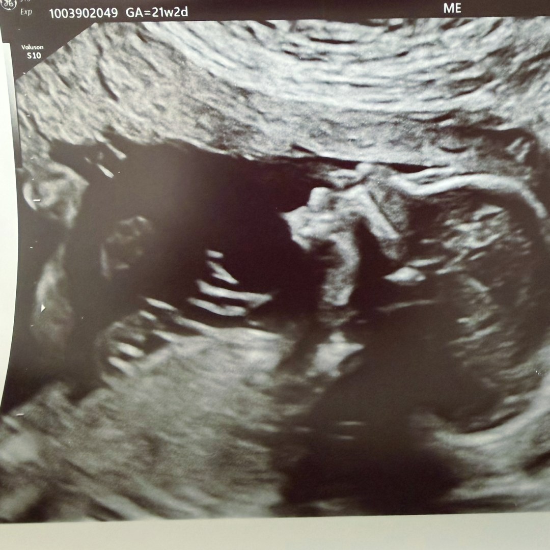 Photo shared by Elizabeth for their Babylist baby registry.