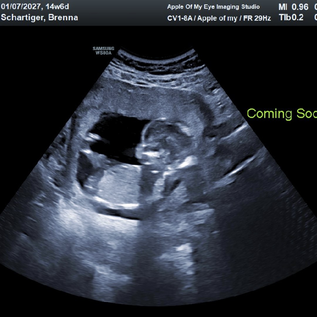 Photo shared by Brenna for their Babylist baby registry.