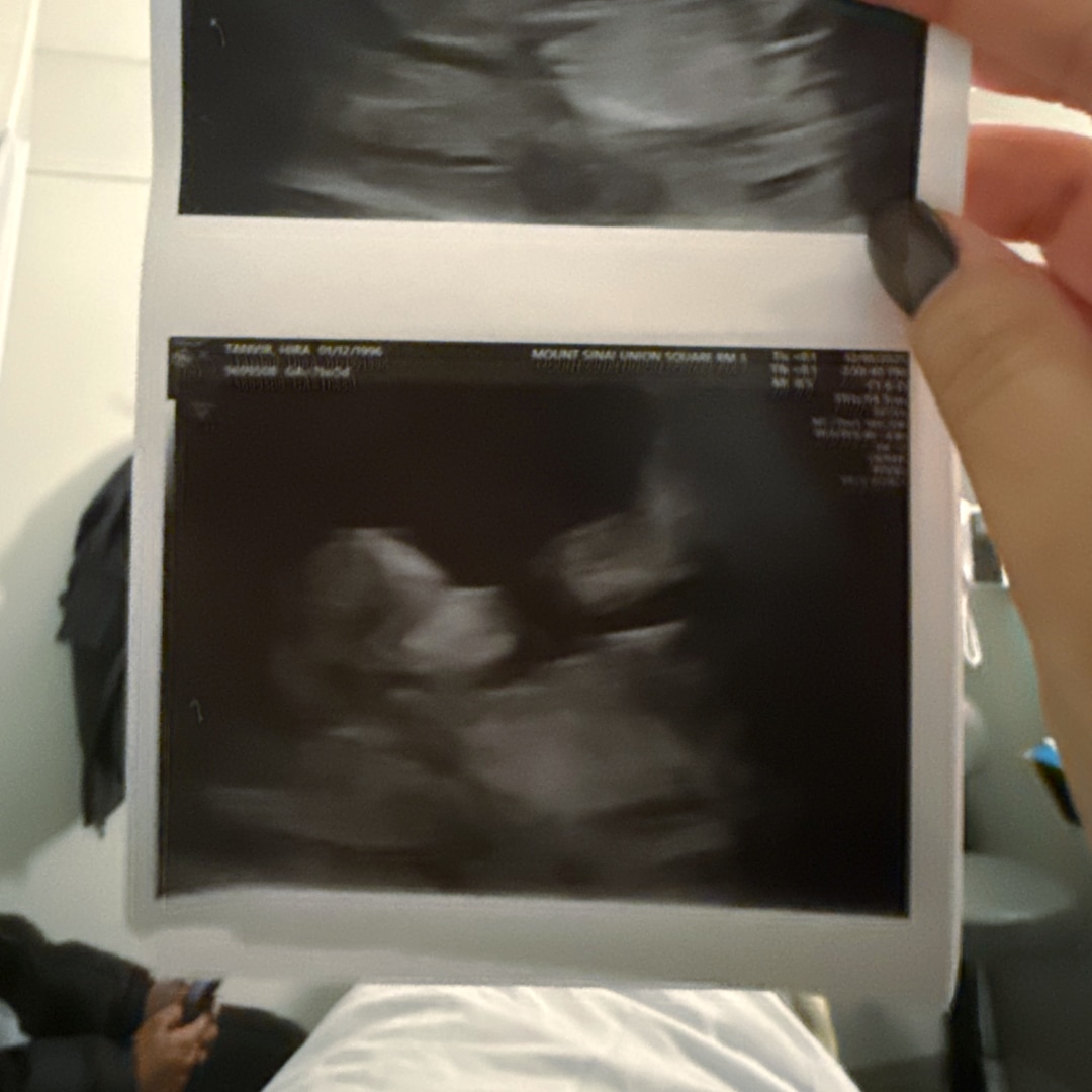 Photo shared by Hira for their Babylist baby registry.